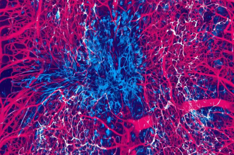 Pericytes, in blue, and vasculature, in pink, at the lesion site one month after a spinal cord injury in an adult mouse. Credit: Andrea Tedeschi/The Ohio State University Building 'cellular bridges' for spinal cord repair after injury