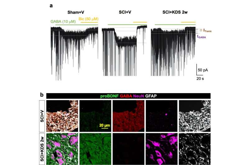 Astrocytic "brake" that blocks spinal cord repair identified